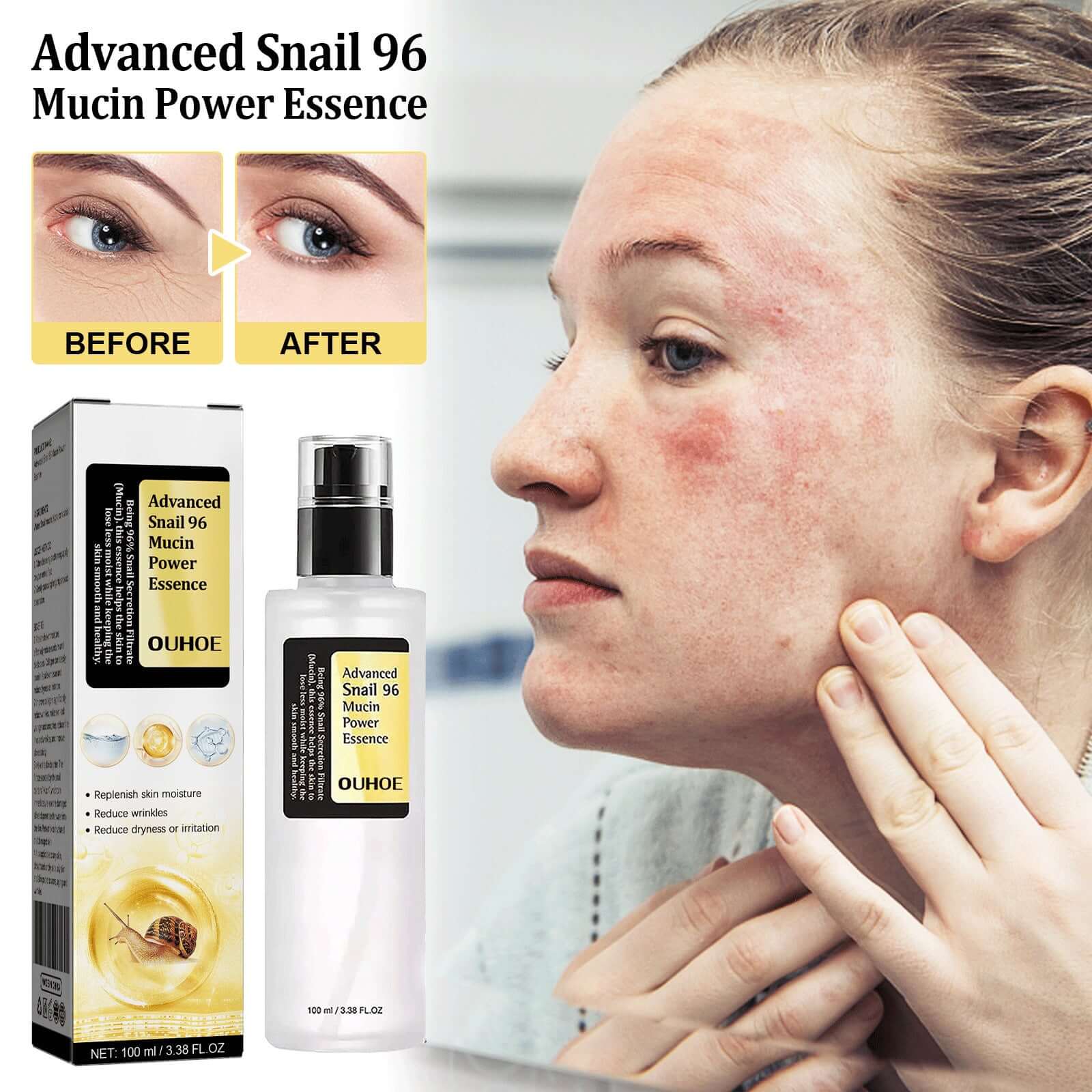 Before and after using Advanced Snail 96 Mucin Power Essence, showcasing improved skin hydration and appearance.