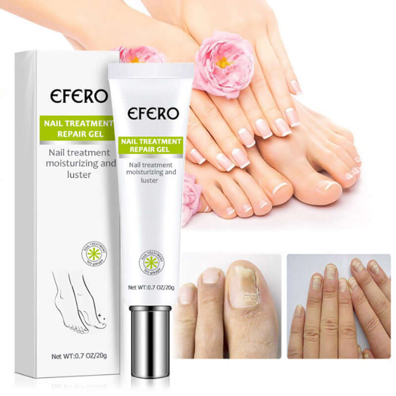 Efero nail treatment repair gel for fungus removal and nail care with healthy feet and hands in background.