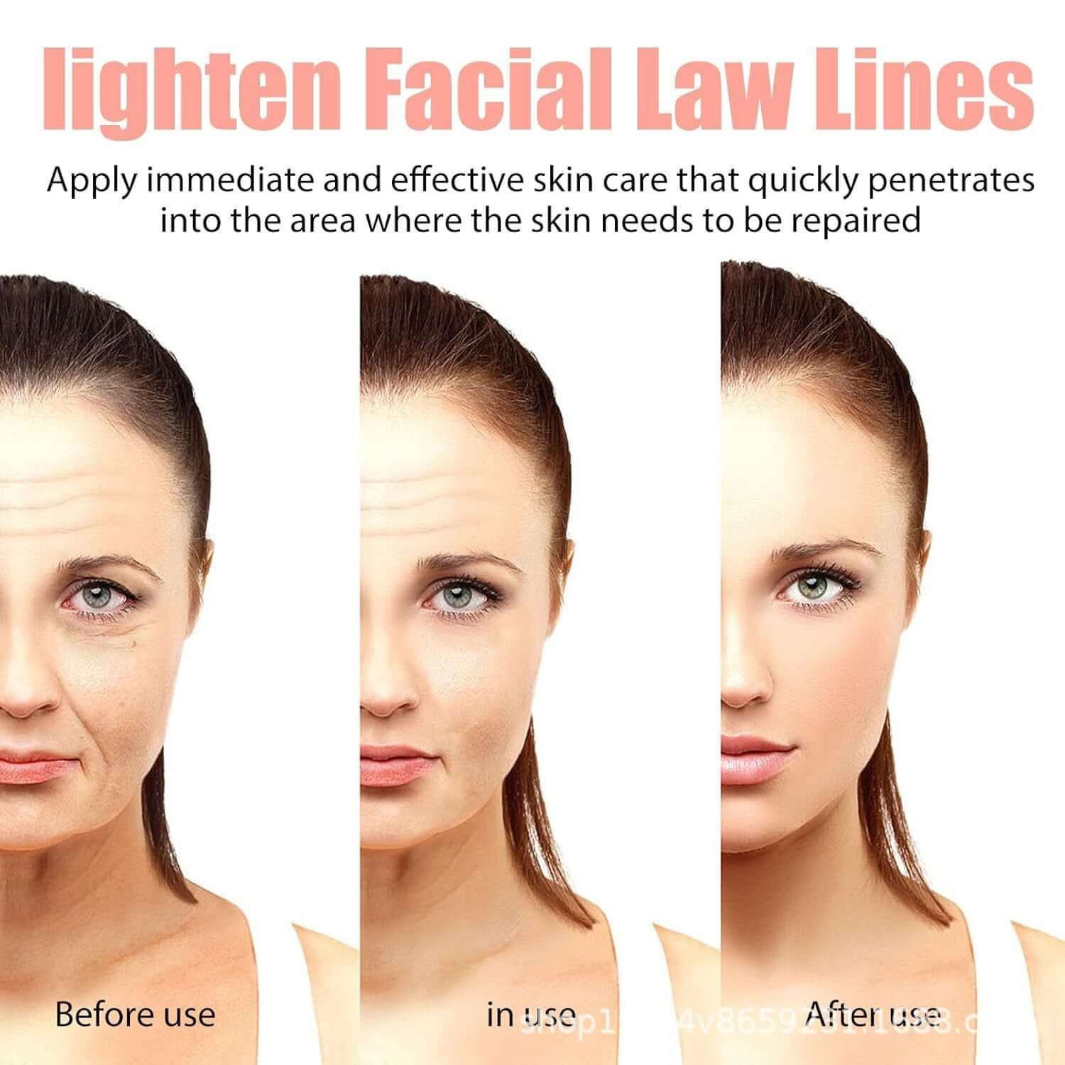 Before and after results showing the effectiveness of a product to lighten facial law lines.