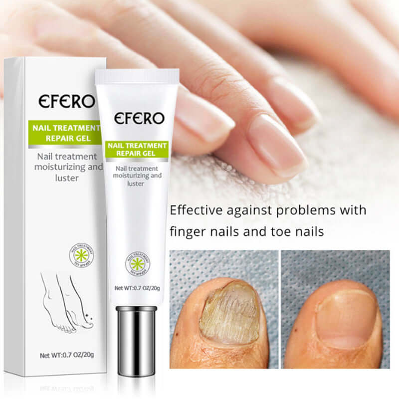 Efero Nail Treatment Repair Gel effective for moisturizing and repairing fingernails and toenails, with pack and usage example.