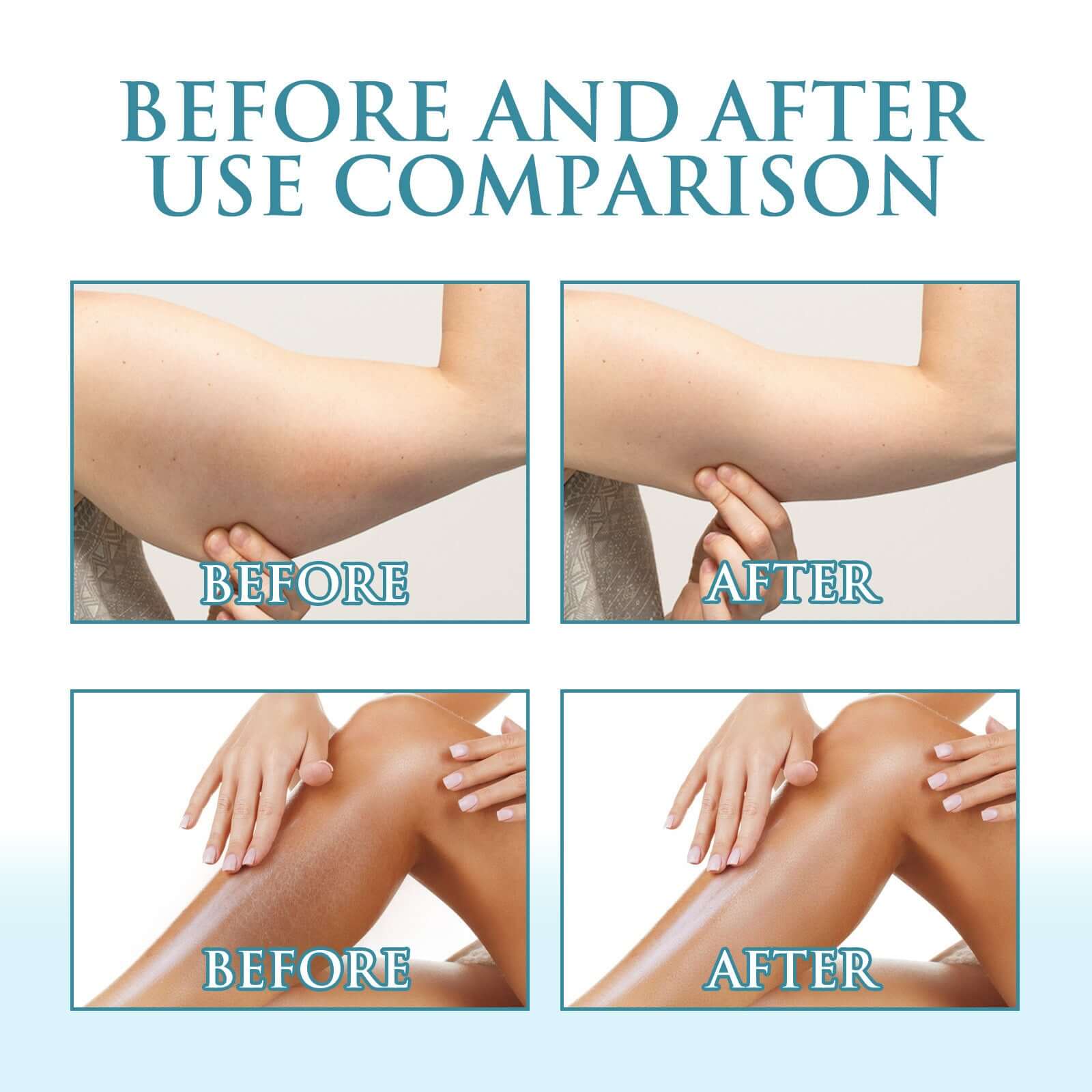 Before and after comparison of skin showing improved hydration and relief from sunburn after using moisturizer.
