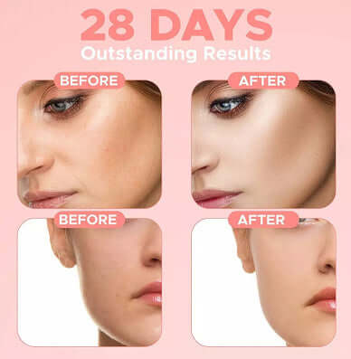 28 days of results showcasing the transformation of facial skin before and after using a skincare product.
