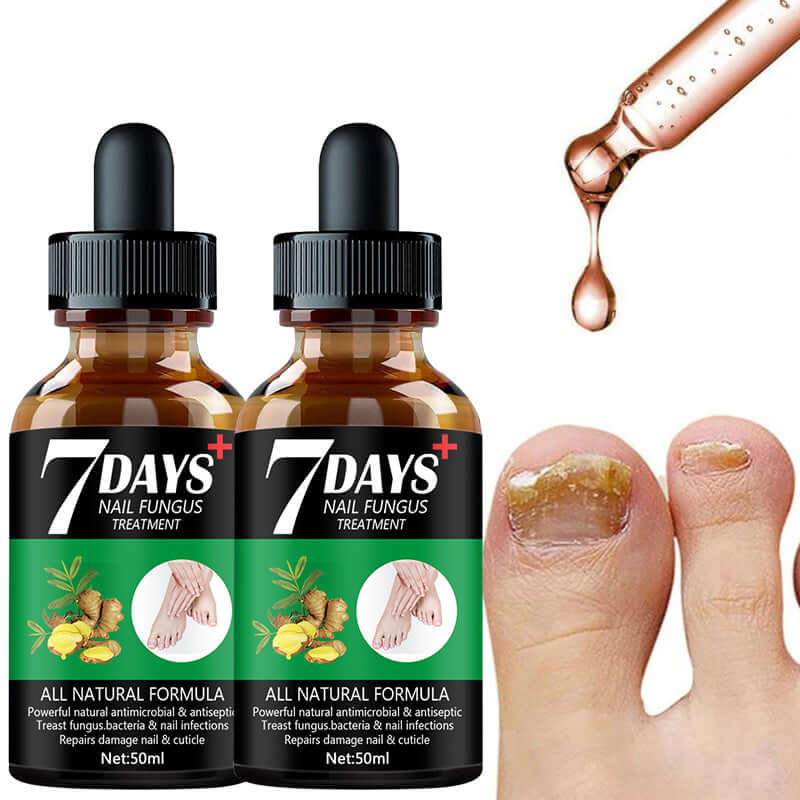 7DAYS Nail Fungus Treatment Serum bottles with dropper, ideal for nail care and infection removal.