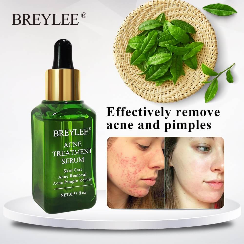 BREYLEE Acne Treatment Serum bottle with natural ingredients, effective for removing acne and pimples, skincare solution.