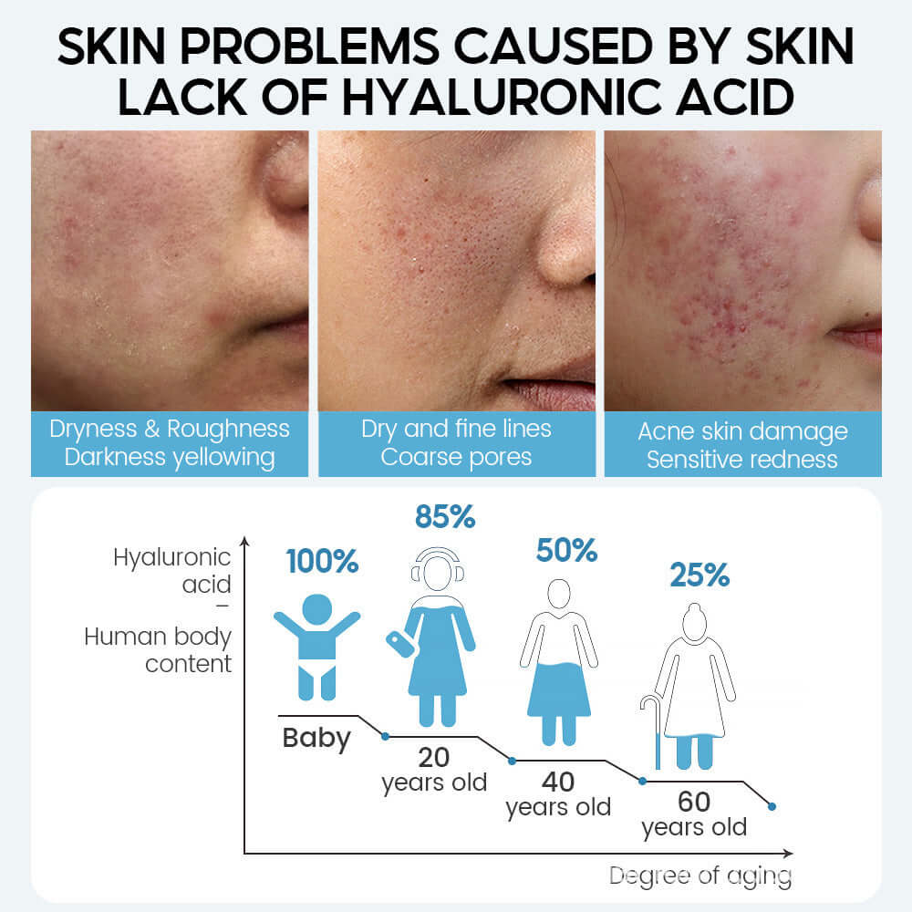 Infographic showing skin issues from hyaluronic acid deficiency, including dryness, fine lines, and age-related changes.