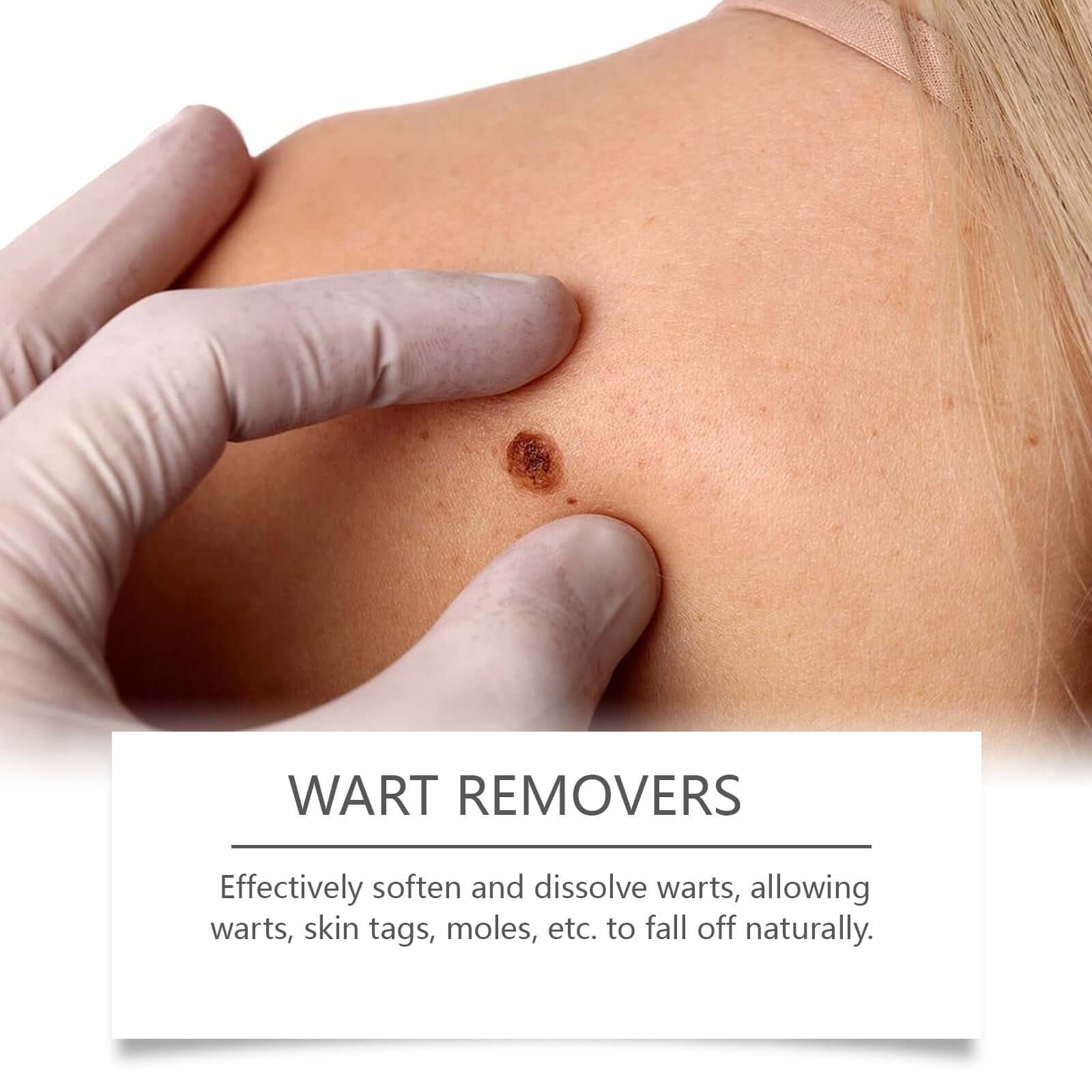 Close-up of a hand applying a wart remover on skin, illustrating effective treatment for warts and skin tags.