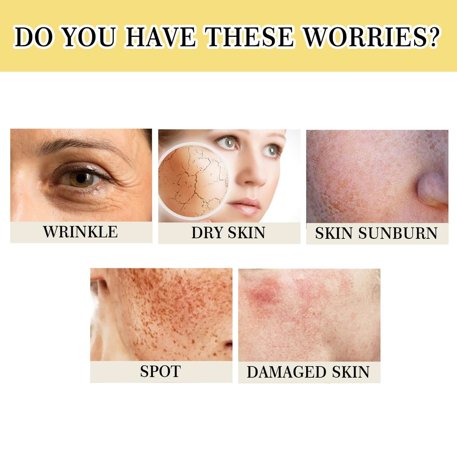 Image showing common skin concerns: wrinkles, dry skin, sunburn, spots, and damaged skin.