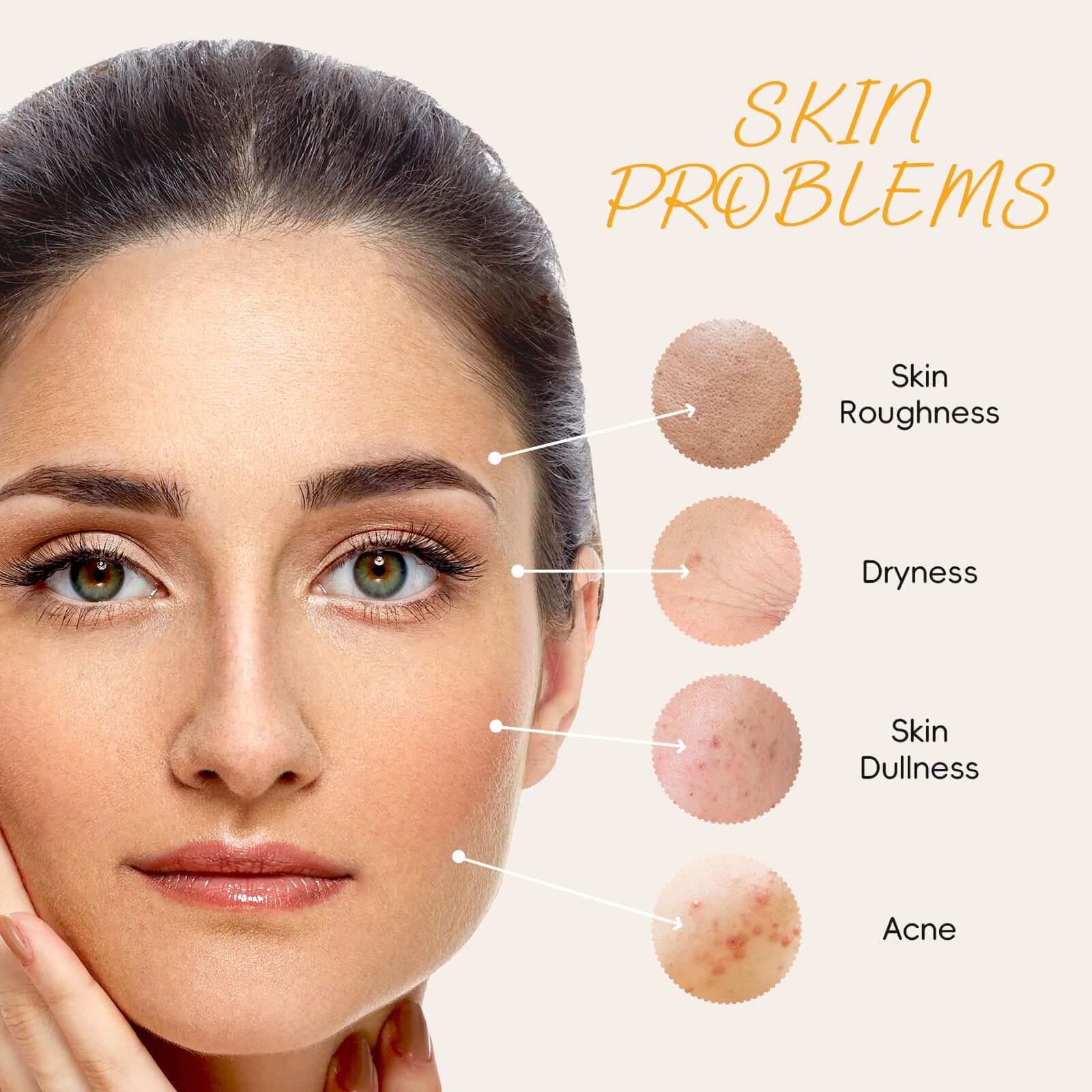 Close-up of a woman displaying common skin problems: roughness, dryness, dullness, and acne.